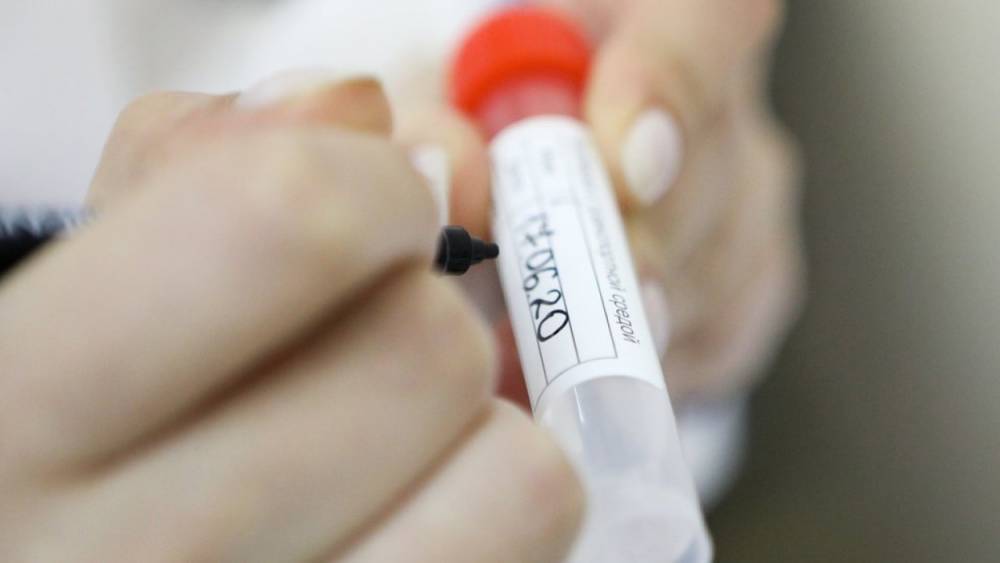 Медики выявили 9169 новых случаев заболевания коронавирусом за сутки в России