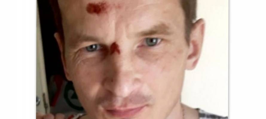 Объявлен в розыск мужчина, который ушел из инфекционной больницы в Петрозаводске и пропал
