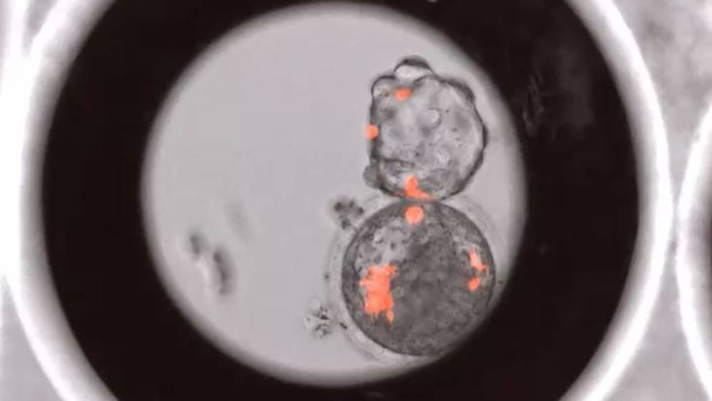 Выращенные человеческие клетки в эмбрионах обезьяны вызывают этические беспокойство у экспертов