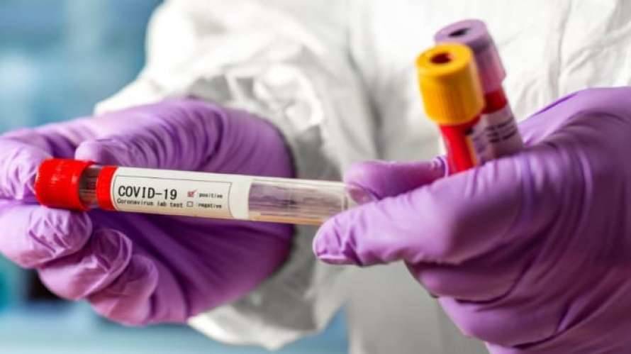 Украина стала второй в Европе по смертности от коронавируса