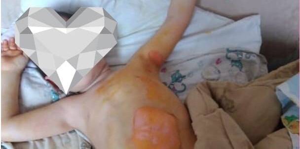 В Копейске СК занялся историей матери, которая три дня не пускала врачей к малышу с ожогом