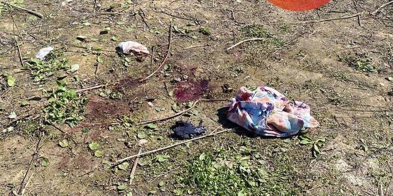 В Голосеевском районе Киева в сумке нашли расчлененное тело мужчины - фото и видео с места - ТЕЛЕГРАФ