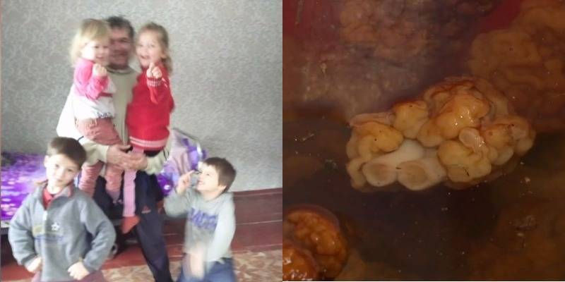 В Черниговской области четверо детей отравились супом из грибов, который сварила мама - ТЕЛЕГРАФ