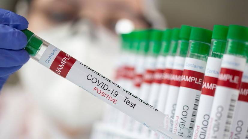 Число случаев коронавируса в Колумбии достигло 2 841 934