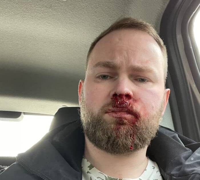 На блогера из Санкт-Петербурга напали после его интервью о жизни с ВИЧ