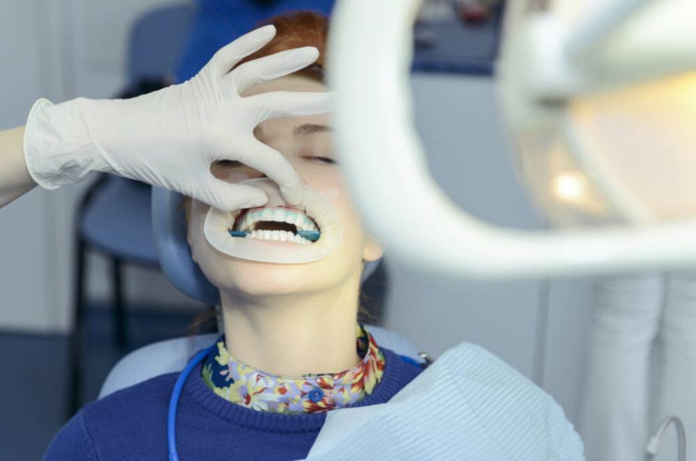 Сколько стоит отбеливание зубов в Германии и кто его оплачивает