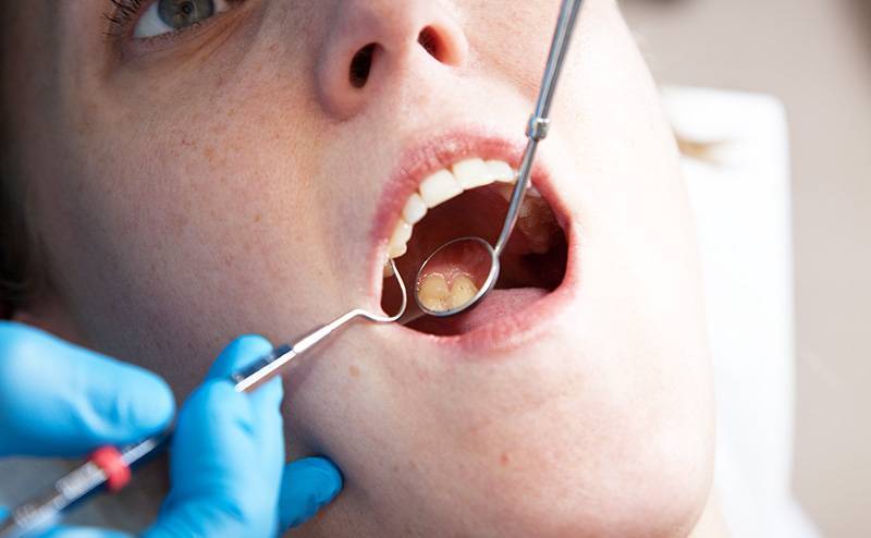 Врач: боль в зубах может быть признаком онкологии