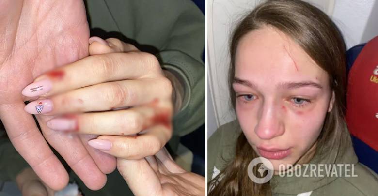 Украинка расцарапала девушке лицо и откусила ноготь за отодвинутое кресло в самолёте