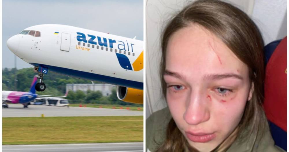 "Погрызла руку и откусила ноготь": украинка пострадала в результате нападения в самолете