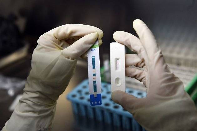 Читинцы смогут бесплатно пройти экспресс-тест на ВИЧ-статус 13 мая