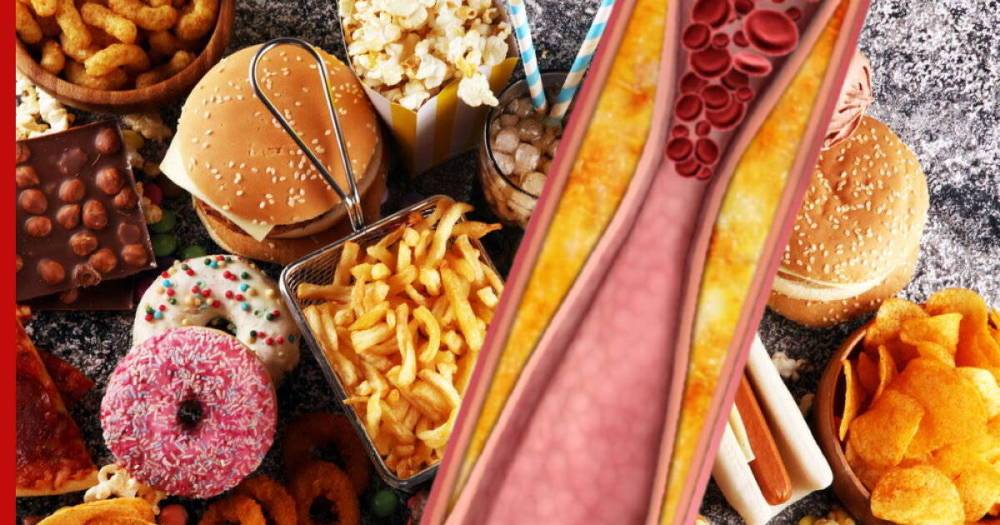 Высокий холестерин: названы пищевые привычки, от которых лучше отказаться