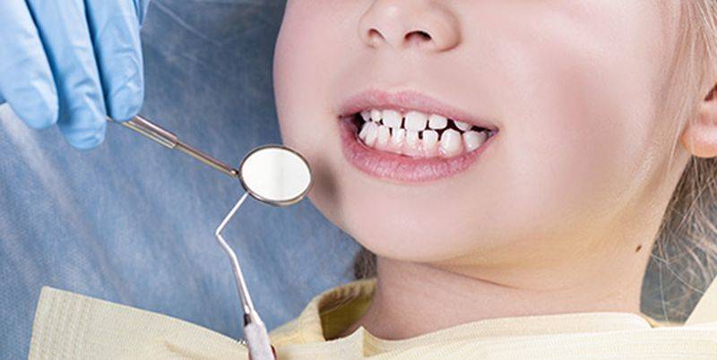 В Ирпене 9-летнему ребенку удалили сразу 12 молочных зубов без согласия матери - ТЕЛЕГРАФ