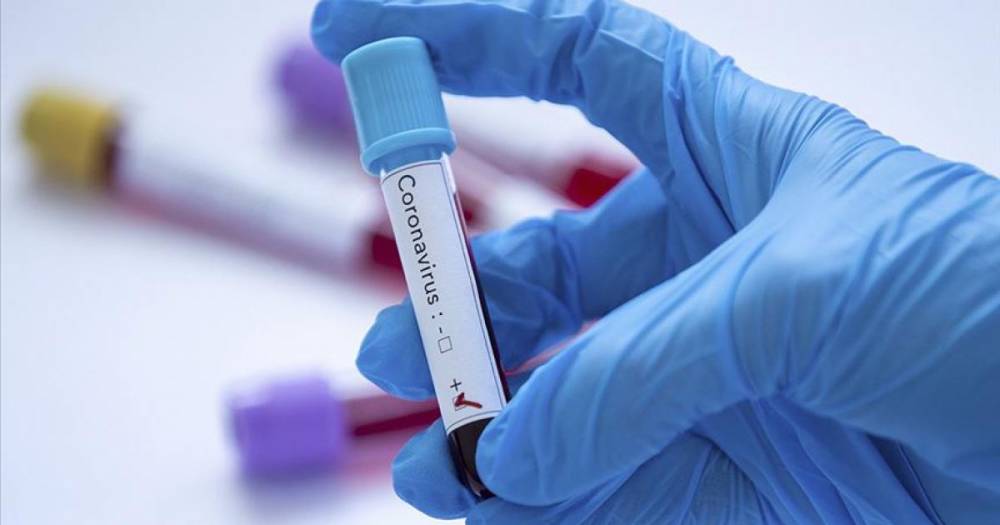 За минувшие сутки в Астраханской области коронавирус подтвержден у 37 человек