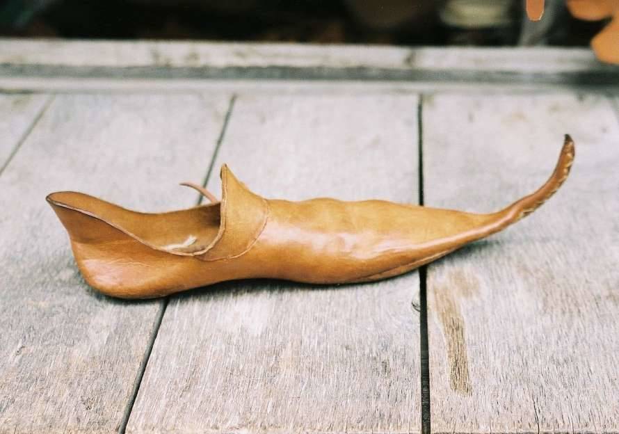 Красота требует жертв. Как остроносые туфли спровоцировали бурсит у английской знати