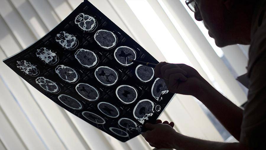 Японские ученые нашли новый способ выявлять рак мозга