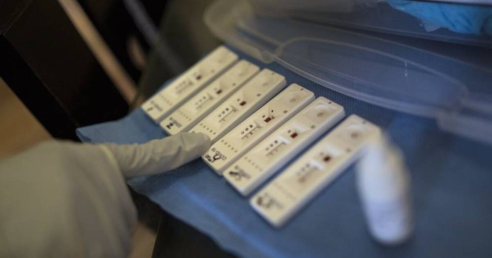 Тест на антитела у вакцинированных может быть отрицательным – МОЗ