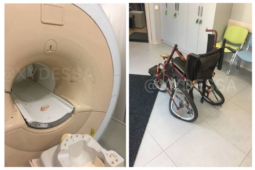 МРТ-аппарат засосал пациента, пришедшего на обследование: кадры и детали жуткого ЧП в Одессе