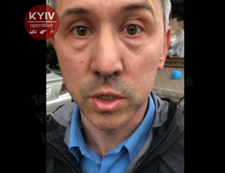 В Киеве агрессивный таксист забрызгал пассажирке с ребенком лицо газовым баллончиком. Фото