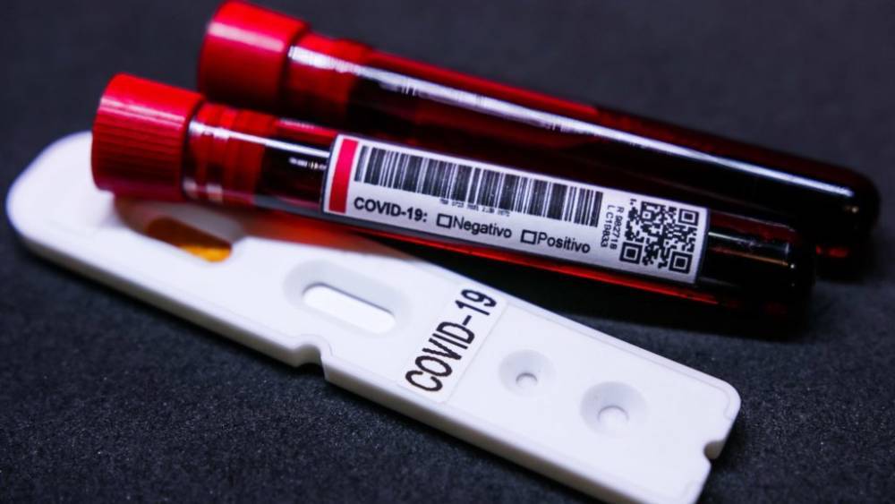 COVID-19 в Украине: за сутки подтвердили менее тысячи новых случаев коронавируса