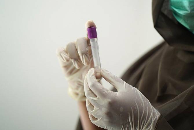 В Украине за сутки от коронавируса умерли 36 человек