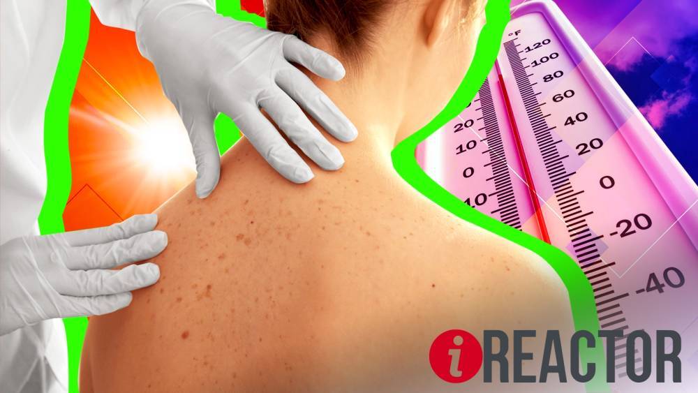 Врач-дерматолог рассказала, как ухаживать за кожей в период аномальной жары