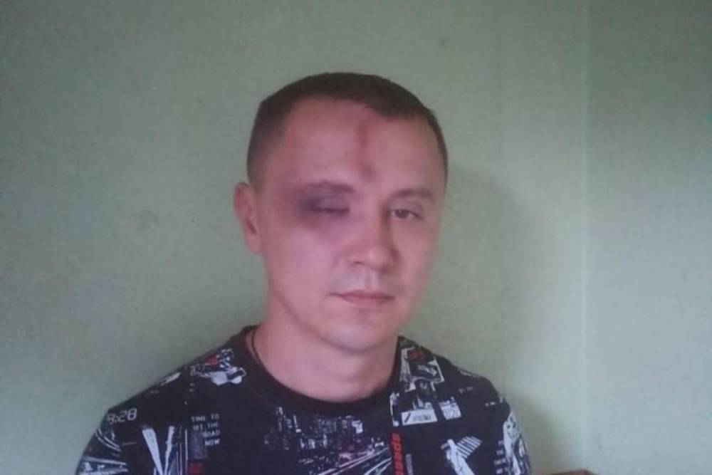 В Новосибирске полиция начала проверку по факту избиения мужчины на улице Ватутина