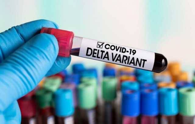 В Киеве почти нет реактивов для определения нового штамма коронавируса “Дельта”