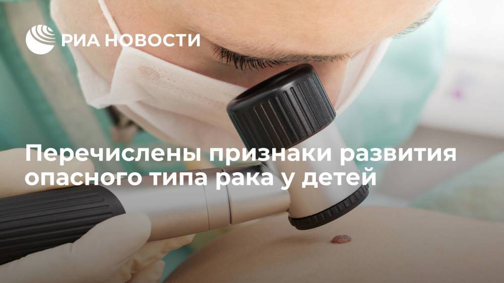 Дерматолог Литвиненко назвал изменение родинок у детей поводом немедленно обратиться к врачу