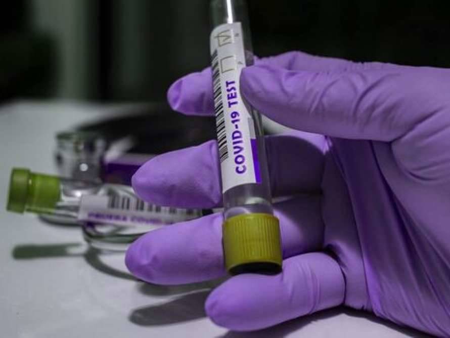 С начала эпидемии коронавируса более одиннадцати миллионов украинцев сдали ПЦР-тесты