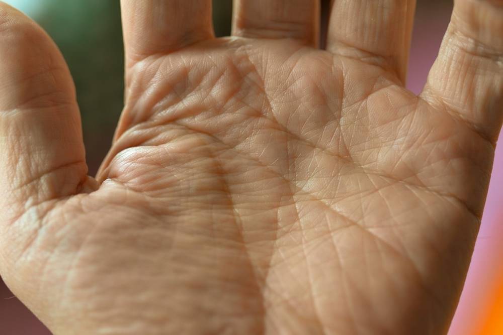 Express: симптомы на руках могут говорить о болезни печени