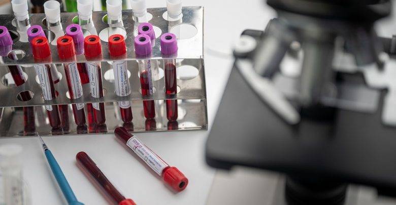 Германия и США совместно разработали вакцину против дельта-штамма коронавируса