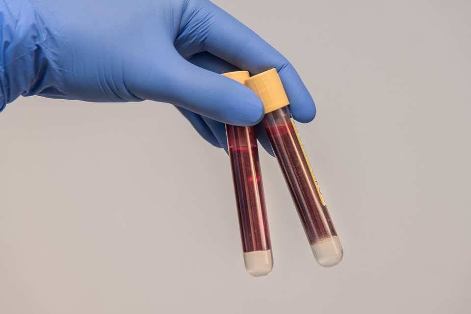 Ученые перечислили "странности" третьей группы крови у человека