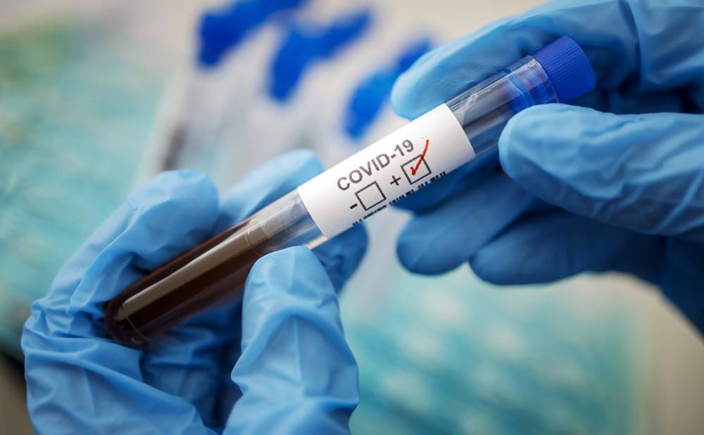 Жителям Нидерландов начали выдавать бесплатные тесты на коронавирус