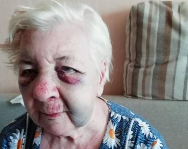 В Волгограде 84-летнюю избитую пенсионерку в 4 утра выставили из больницы