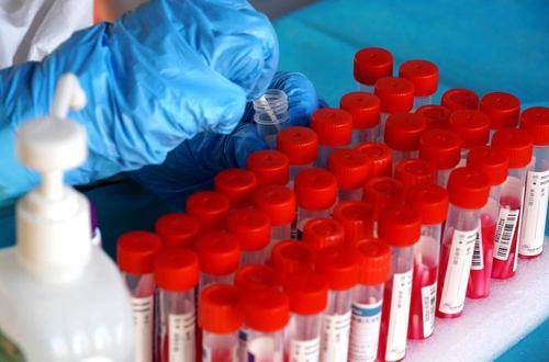 В России впервые с конца июня выявили менее 21 тысячи случаев заражения коронавирусом