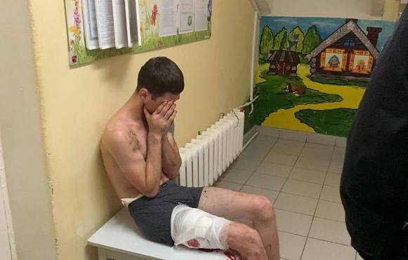 В Иванове мужчина объяснил, зачем голым ворвался в детский садик