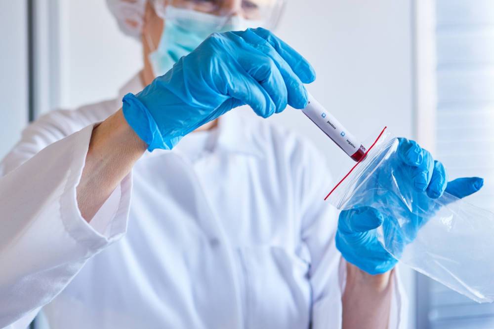 Ученые в Петербурге завершают доклинические испытания теста на клеточный иммунитет от коронавируса