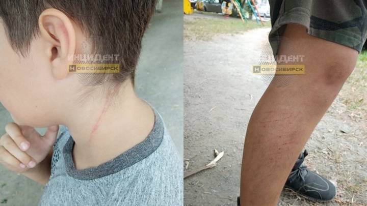 Перелом позвоночника: в Новосибирске сотрудница салона красоты напала на мальчика