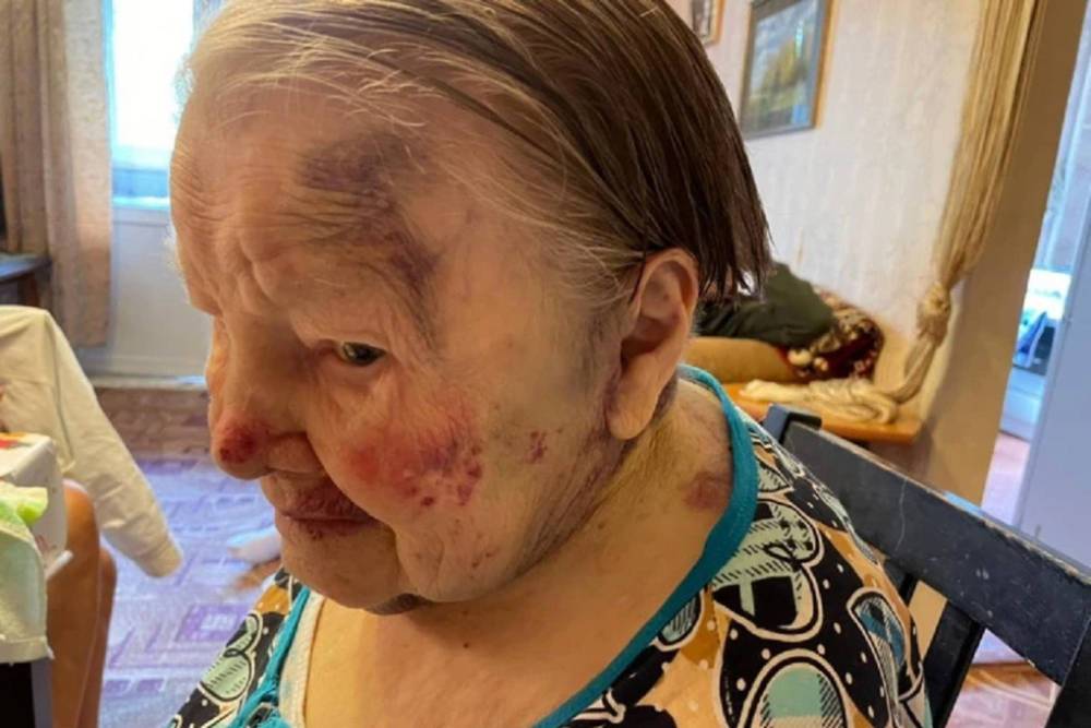 Сиделку службы «Милосердия» обвиняют в жестоком избиении 95-летней подопечной в Екатеринбурге