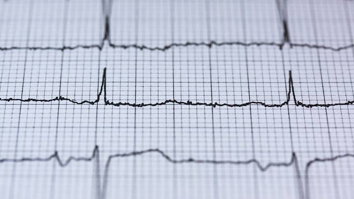 Кардиолог перечислила неожиданные признаки инфаркта