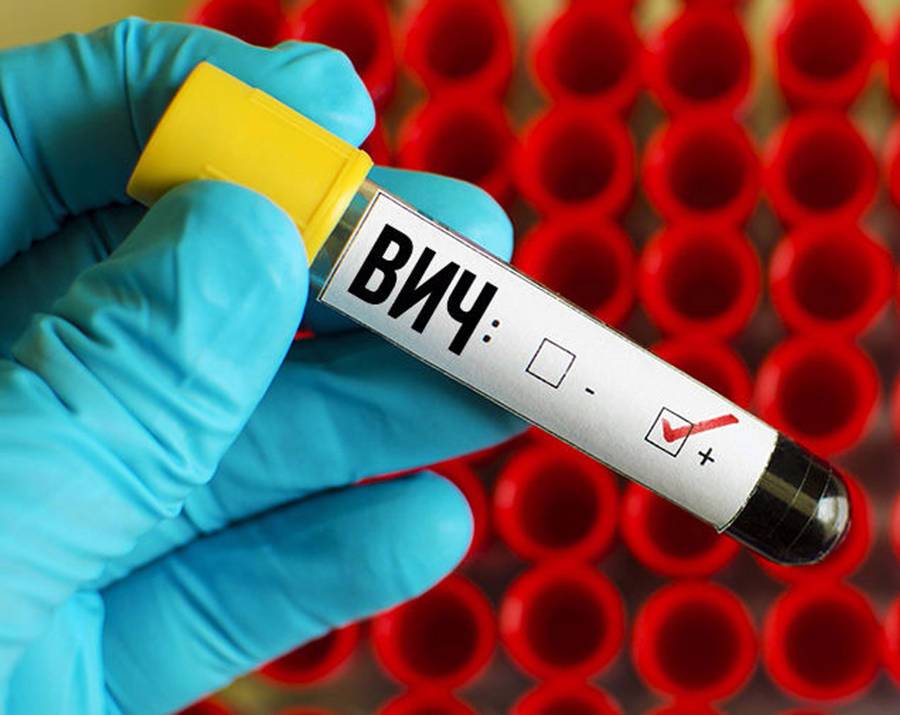 За восемь месяцев 2021 года в Беларуси зарегистрировано 1013 новых случаев ВИЧ-инфекции