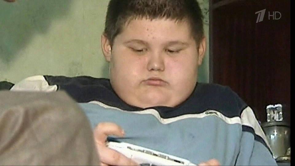 Проблему детского ожирения обсудил Совет по вопросам попечительства в социальной сфере