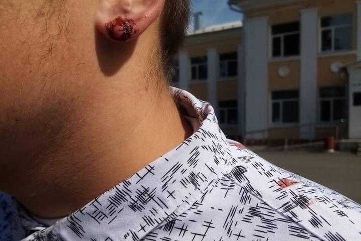 В комитете образования Курской области прокомментировали инцидент с разорванным ухом ученика за отказ снимать сережку