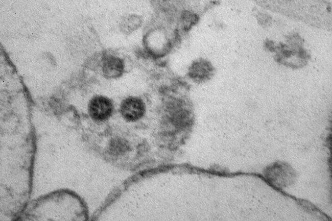 ВОЗ дала неутешительный прогноз по коронавирусу для Европы