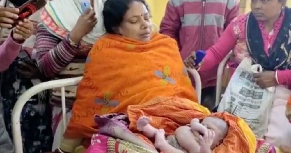 Воплощение Брахмы: в Индии родился ребенок, у которого четыре руки и ноги (видео)