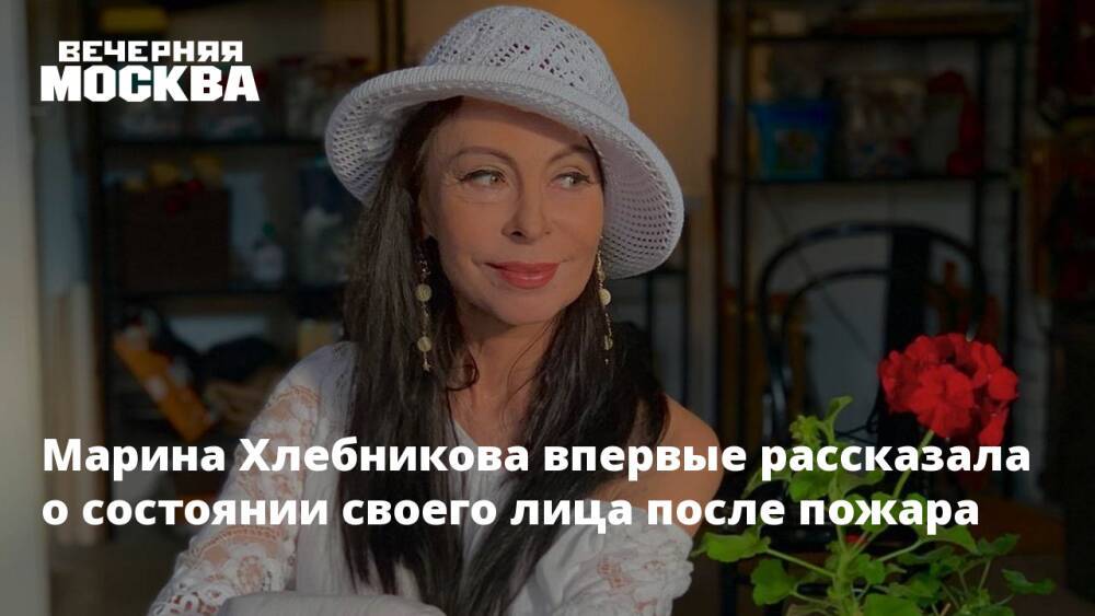 Марина Хлебникова впервые рассказала о состоянии своего лица после пожара