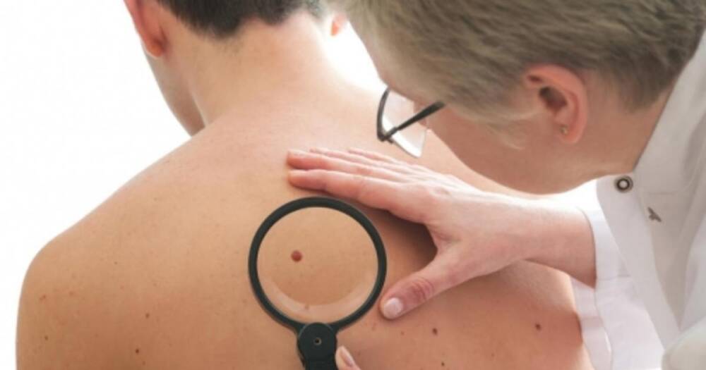 Врач перечислила шесть главных кожных симптомов рака легких