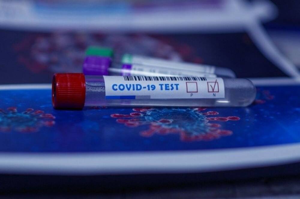 В РФ за сутки выявили 74 692 новых случая коронавируса