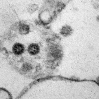 Первый случай заражения штаммом коронавируса "омикрон" выявлен в Нижегородской области