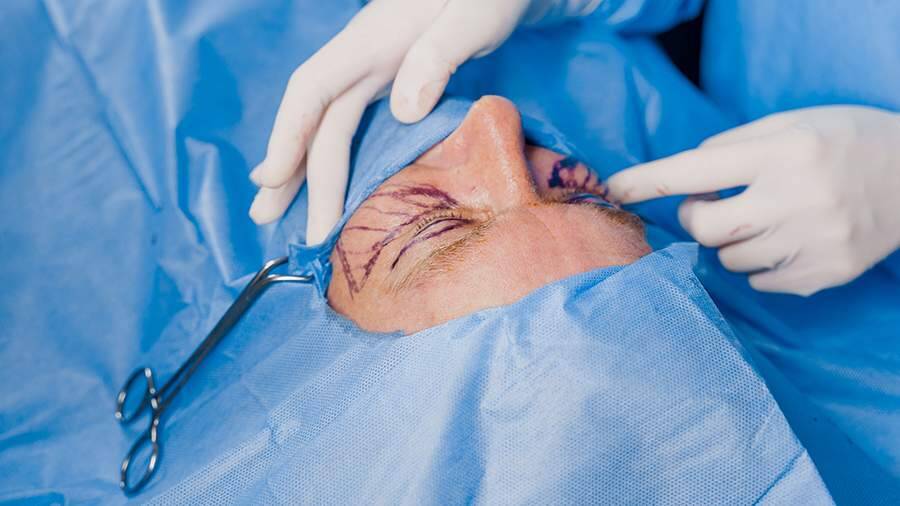 Хирург назвал пять самых популярных пластических операций среди мужчин